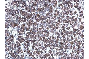 Immunohistochemistry (IHC) image for anti-Golgi-Associated, gamma Adaptin Ear Containing, ARF Binding Protein 3 (GGA3) (C-Term) antibody (ABIN2856386)