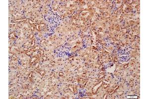 Immunohistochemistry (Paraffin-embedded Sections) (IHC (p)) image for anti-Beclin 1, Autophagy Related (BECN1) (AA 201-330) antibody (ABIN675384)