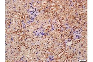 Formalin-fixed and paraffin embedded rat kidney labeled with Anti-Beclin 1/ATG6 Polyclonal Antibody, Unconjugated  at 1:200 followed by conjugation to the secondary antibody and DAB staining (Beclin 1 抗体  (AA 201-330))