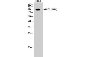 Western Blotting (WB) image for anti-Polycystic Kidney Disease 2 (Autosomal Dominant) (PKD2) (pSer876) antibody (ABIN5962048) (PKD2 抗体  (pSer876))