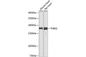 Western blot analysis of extracts of various cell lines using THBS2 Polyclonal Antibody at dilution of 1:1000. (Thrombospondin 2 抗体)