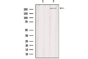 Western blot analysis of extracts from rat brain, using CHD8 Antibody. (CHD8 抗体  (C-Term))