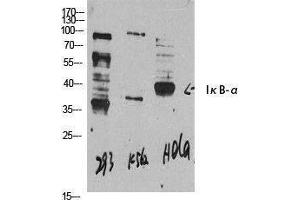 Western Blotting (WB) image for anti-Nuclear Factor of kappa Light Polypeptide Gene Enhancer in B-Cells Inhibitor, alpha (NFKBIA) (N-Term) antibody (ABIN3175722) (NFKBIA 抗体  (N-Term))