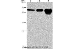 Western blot analysis of 823 cell, mouse brain and human fetal brain tissue, using MMP20 Polyclonal Antibody at dilution of 1:400 (MMP20 抗体)