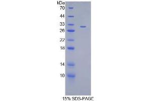 SDS-PAGE analysis of Mouse ANGPTL2 Protein. (ANGPTL2 蛋白)