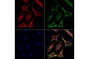 ABIN6265555 and ABIN6266853 staining Hela by IF/ICC. (Transglutaminase 2 抗体  (N-Term))