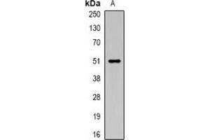 Western blot analysis of Carboxypeptidase A6 expression in rat testis (A) whole cell lysates. (CPA6 抗体)