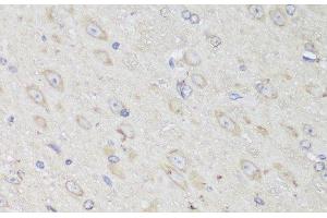 Immunohistochemistry of paraffin-embedded Mouse brain using GANAB Polyclonal Antibody at dilution of 1:150 (40x lens). (GANAB 抗体)
