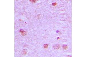 Immunohistochemical analysis of NCOA7 staining in human brain formalin fixed paraffin embedded tissue section. (NCOA7 抗体  (Center))