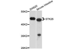 Western blot analysis of extracts of various cell lines, using STK25 antibody (ABIN5996002) at 1/1000 dilution. (STK25 抗体)