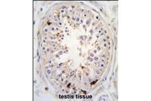 Immunohistochemistry (Paraffin-embedded Sections) (IHC (p)) image for anti-Ubiquitin Specific Peptidase 2 (USP2) (AA 508-538), (C-Term) antibody (ABIN388879)