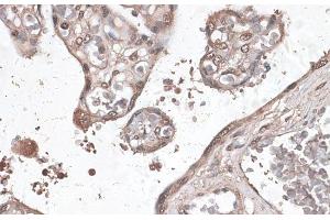 Immunohistochemistry of paraffin-embedded Human placenta using MEF2C Polyclonal Antibody at dilution of 1:100 (40x lens). (MEF2C 抗体)