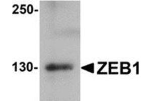Western blot analysis of ZEB1 in HeLa cell lysate with ZEB1 antibody at 1 μg/ml. (ZEB1 抗体  (Center))