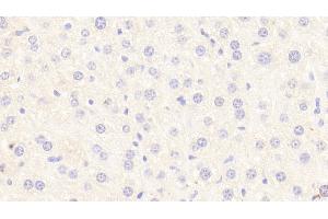 Immunohistochemistry (IHC) image for anti-Signal Transducer and Activator of Transcription 3 (Acute-Phase Response Factor) (STAT3) (AA 346-552) antibody (ABIN7444052)