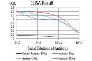 Black line: Control Antigen (100 ng),Purple line: Antigen (10 ng), Blue line: Antigen (50 ng), Red line:Antigen (100 ng) (IL9 Receptor 抗体  (AA 41-270))