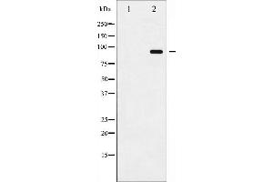 Western blot analysis of ADAM 17 phosphorylation expression in K562UV treated whole cell lysates,The lane on the left is treated with the antigen-specific peptide. (ADAM17 抗体  (pThr735))