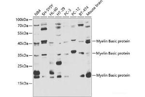 Western blot analysis of extracts of various cell lines using Myelin Basic protein Polyclonal Antibody at dilution of 1:1000. (MBP 抗体)