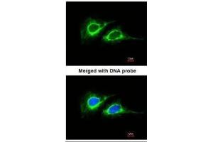 ICC/IF Image Immunofluorescence analysis of paraformaldehyde-fixed HeLa, using Cytokeratin 18 , antibody at 1:200 dilution. (Cytokeratin 18 抗体)