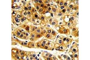 Immunohistochemistry (IHC) image for anti-Nuclear Factor of kappa Light Polypeptide Gene Enhancer in B-Cells Inhibitor, alpha (NFKBIA) (AA 12-41) antibody (ABIN3032048)