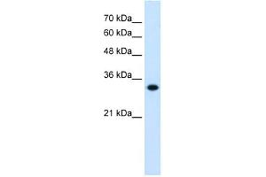 HMGCL antibody used at 0. (HMGCL 抗体)