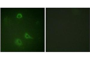 Immunofluorescence staining of methanol-fixed A549 cells using NMDAR1 (Phospho-Ser890) Antibody. (GRIN1/NMDAR1 抗体  (pSer890))