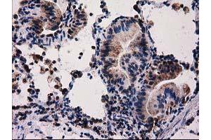 Image no. 5 for anti-Family with Sequence Similarity 127, Member C (FAM127C) antibody (ABIN1498197) (FAM127C 抗体)