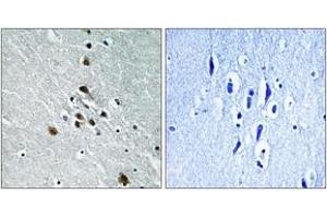 Immunohistochemistry analysis of paraffin-embedded human brain, using SF1 (Phospho-Ser82) Antibody. (Splicing Factor 1 抗体  (pSer82))
