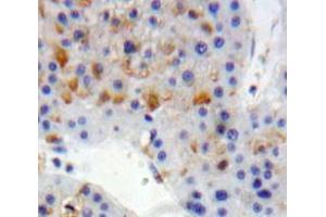 IHC-P analysis of Liver tissue, with DAB staining. (LDLR 抗体  (AA 497-742))
