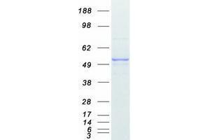 Western Blotting (WB) image for Vitamin D Receptor (VDR) (Transcript Variant 1) protein (Myc-DYKDDDDK Tag) (ABIN2735369)