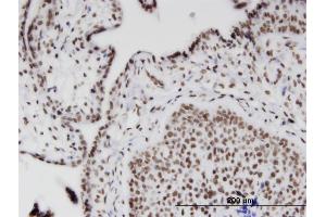 Immunoperoxidase of monoclonal antibody to RIOK2 on formalin-fixed paraffin-embedded human placenta. (RIOK2 抗体  (AA 453-551))