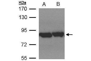 WB Image Sample(30 μg of whole cell lysate) A:Hep G2, B:MOLT4, 7. (TRAP1 抗体)