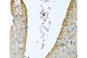 Immunohistochemistry of paraffin-embedded Mouse heart using COX5B Polyclonal Antibody at dilution of 1:100 (40x lens). (COX5B 抗体)