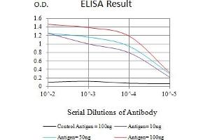 Black line: Control Antigen (100 ng),Purple line: Antigen (10 ng), Blue line: Antigen (50 ng), Red line:Antigen (100 ng)