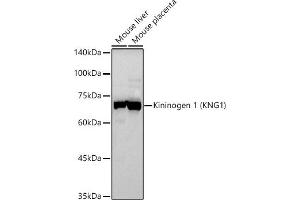 Western blot analysis of extracts of various cell lines, using Kininogen 1 (KNG1) antibody (ABIN3022363, ABIN3022364, ABIN3022365 and ABIN6218762) at 1:500 dilution. (KNG1 抗体  (AA 148-427))