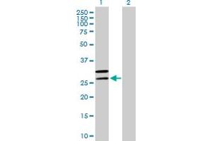 Western Blot analysis of MRPL2 expression in transfected 293T cell line by MRPL2 MaxPab polyclonal antibody. (MRPL2 抗体  (AA 1-305))