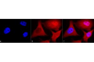 Immunocytochemistry/Immunofluorescence analysis using Mouse Anti-Ubiquitin Monoclonal Antibody, Clone 6C11-B3 (ABIN361817 and ABIN361816). (Ubiquitin 抗体)