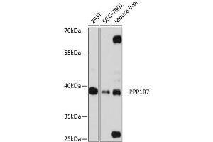 Western blot analysis of extracts of various cell lines, using PPP1R7 antibody (ABIN6132827, ABIN6146072, ABIN6146074 and ABIN6216881) at 1:3000 dilution.