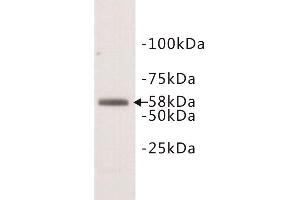 Western Blotting (WB) image for anti-Deoxynucleotidyltransferase, terminal (DNTT) (N-Term) antibody (ABIN1854984) (TdT 抗体  (N-Term))