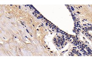 Detection of RIPK1 in Human Mammary gland Tissue using Polyclonal Antibody to Receptor Interacting Serine Threonine Kinase 1 (RIPK1) (RIPK1 抗体  (AA 17-289))