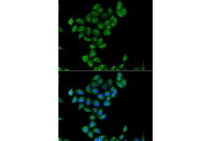 Immunofluorescence analysis of  cells using COQ3 antibody (ABIN6133353, ABIN6138894, ABIN6138895 and ABIN6223356). (COQ3 抗体  (AA 50-369))