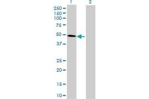 Western Blot analysis of CDC123 expression in transfected 293T cell line by CDC123 MaxPab polyclonal antibody. (CDC123 抗体  (AA 1-336))