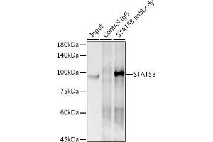 Immunoprecipitation analysis of 300 μg extracts of HeLa cells using 3 μg STB antibody (ABIN7270311). (STAT5B 抗体)