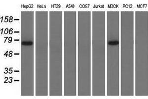 Western blot analysis of extracts (35 µg) from 9 different cell lines by using anti-PEX5 monoclonal antibody. (PEX5 抗体)