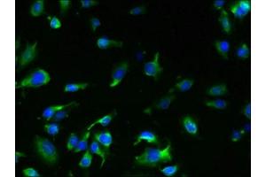 Immunofluorescent analysis of U251 cells using ABIN7173253 at dilution of 1:100 and Alexa Fluor 488-congugated AffiniPure Goat Anti-Rabbit IgG(H+L) (TMEM61 抗体  (AA 90-210))