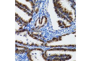 Immunohistochemistry of paraffin-embedded rat fallopian tube using HSPH1 antibody (ABIN2563287) at dilution of 1:100 (40x lens). (HSPH1 抗体)