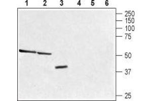 Western blot analysis of rat liver (lane 1 and 4), mouse kidney (lanes 2 and 5) and human brain glioblastoma (U-87) cell (lanes 3 and 6) lysates: - 1-3. (TAAR1 抗体  (C-Term, Intracellular))