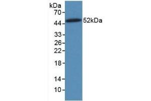 Detection of Recombinant VIM, Human using Monoclonal Antibody to Vimentin (VIM) (Vimentin 抗体)