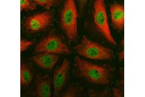 IF analysis of SMC4 using anti-SMC4 antibody (ABIN7602662) and anti-Tubulin Alpha antibody (ABIN7600339).