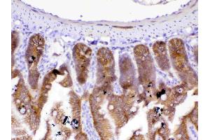 Immunohistochemistry (IHC) image for anti-Catenin (Cadherin-Associated Protein), beta 1, 88kDa (CTNNB1) (AA 2-233) antibody (ABIN5518980)