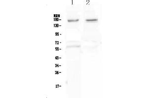 Western blot analysis of Neurexin 1 using anti-Neurexin 1 antibody . (Neurexin 1 抗体  (AA 141-294))